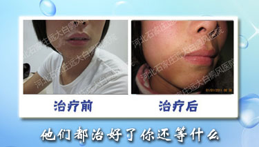 易舒洁免洗手消毒液 第210页
